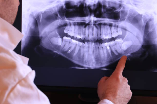 Best Tooth Pain Emergency Relief  in Vandalia, IL